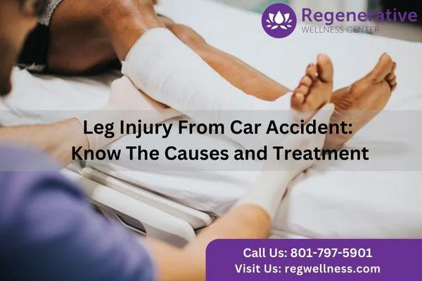 Most Common Leg Injuries From Car Accidents