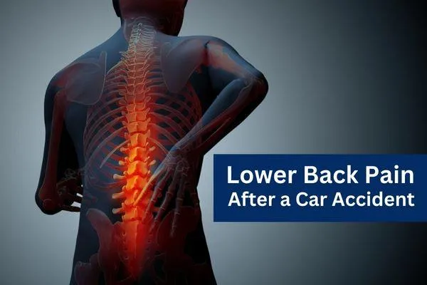 10 Ways to Treat Lower Back Pain After a Car Accident in Millcreek