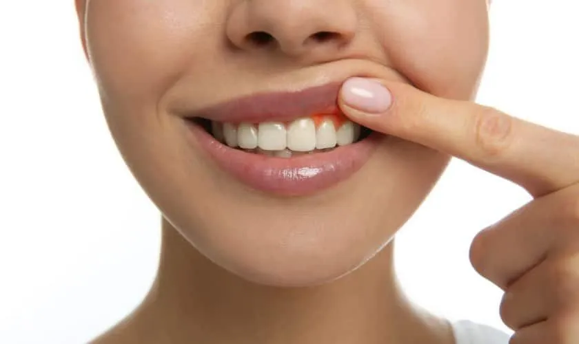 “Dental hygienist examining early signs of gum disease at Osuna Dental Care in Albuquerque.”