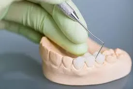Exploring the Different Types of Dental Bridges