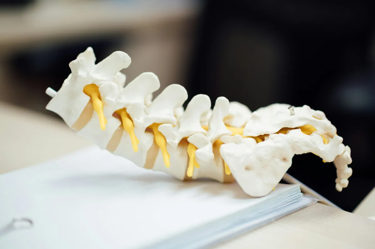 Should I Get A Radiofrequency Ablation?