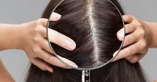 Scalp Health 101: Eufora Treatments & Expert Care at Avera Hair Studio