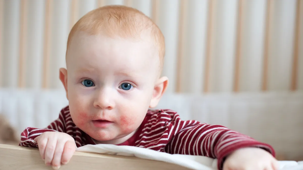 diagnosticar dermatitis