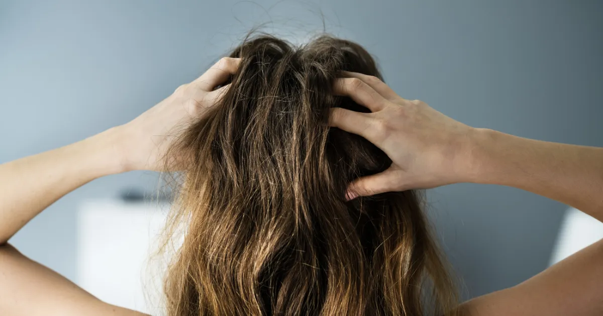 Controlar el picor de la psoriasis