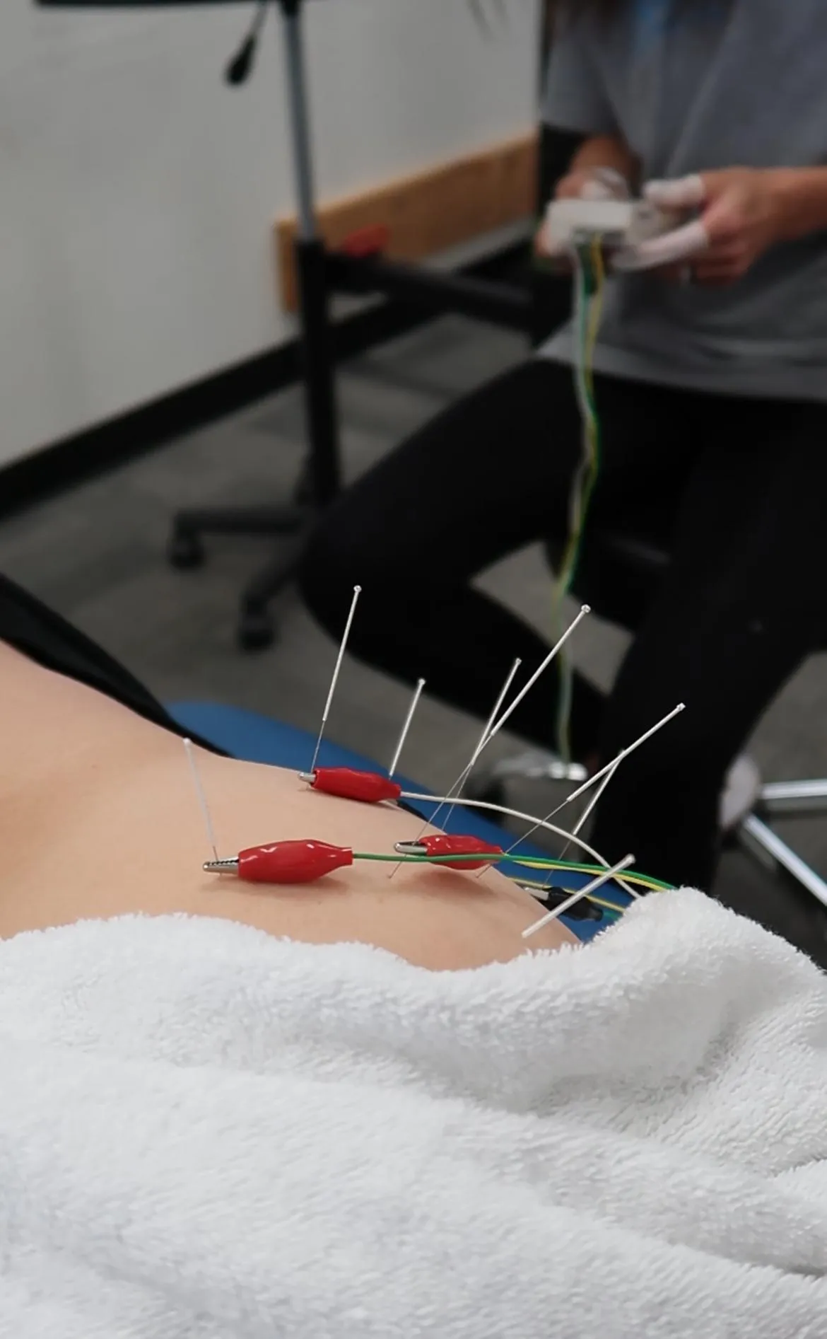 Sciatica