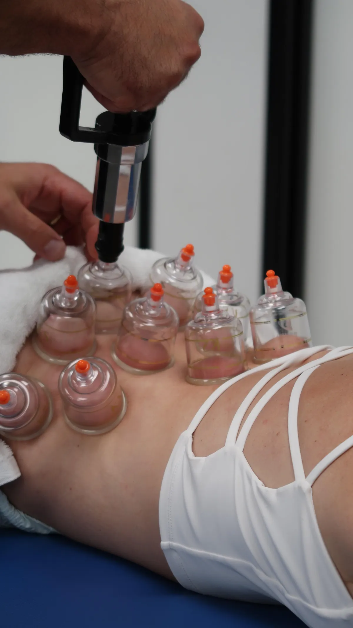 Physical therapist performing cupping therapy to reduce muscle tension and improve recovery in Peoria, Arizona