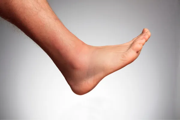 Bumps, Lumps & Odd Shapes: What Are They and Should You Worry?