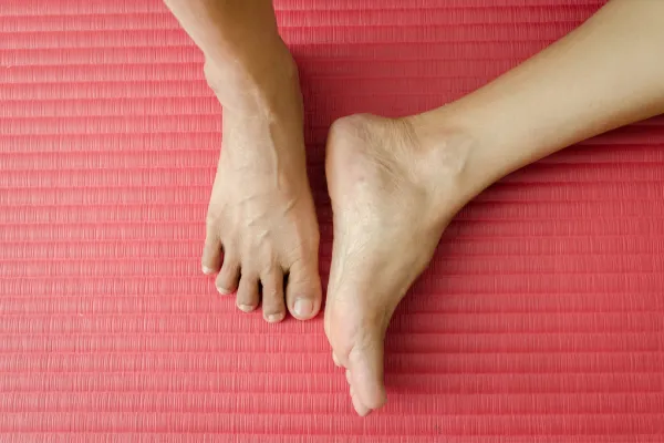 Why Is My Foot Slapping the Ground? Understanding Foot Drop