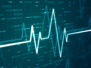 ECG