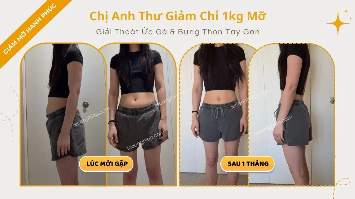 Case Study Giảm Mỡ Bụng Gọn Bắp Tay Trong 1 Tháng Chị Anh Thư - Giảm Mỡ Hạnh Phúc
