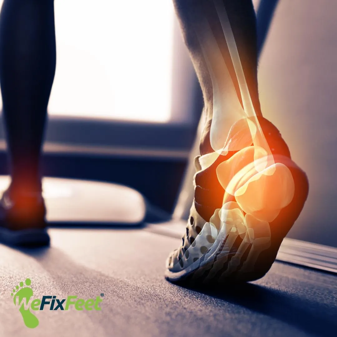 How Long Should Foot & Heel Pain Take to Heal?