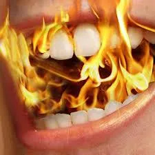 Understanding and Addressing Burning Mouth Syndrome (BMS)