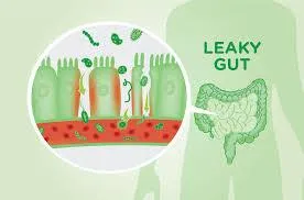 Unlocking Gut Health: Foods and Supplements for Healing a Leaky Gut
