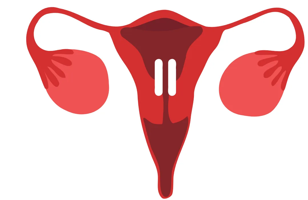 Illustration of a woman’s uterus and ovaries highlighting hormonal changes during perimenopause