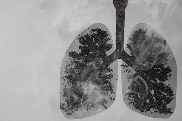 X-ray of lungs, symbolizing coverage for special procedures and complex health conditions like pre-existing and congenital issues