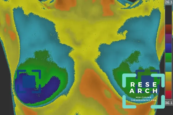 breast-thermography-research