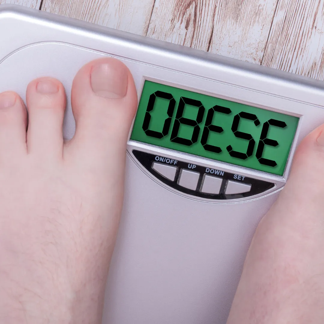 obesity photo