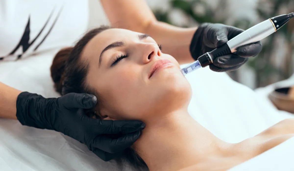 Microneedling Treatment