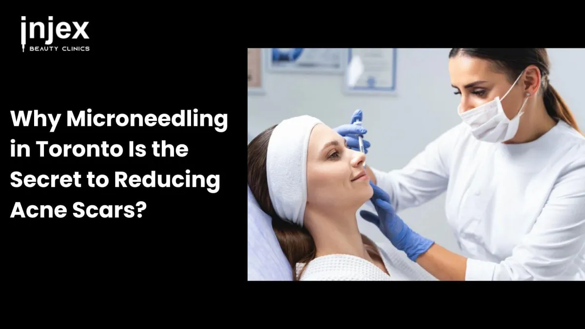 Microneedling in Toronto