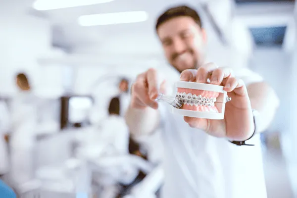 Si tienes braces aqui estan los habitos mas importantes para tu salud