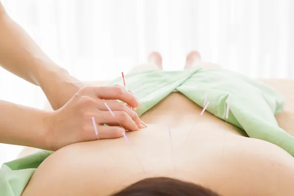 Ancient Wisdom for Modern Motherhood: Acupuncture Throughout the Perinatal Journey
