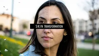 Chemical Peel Before After: Real Results That Transform Skin