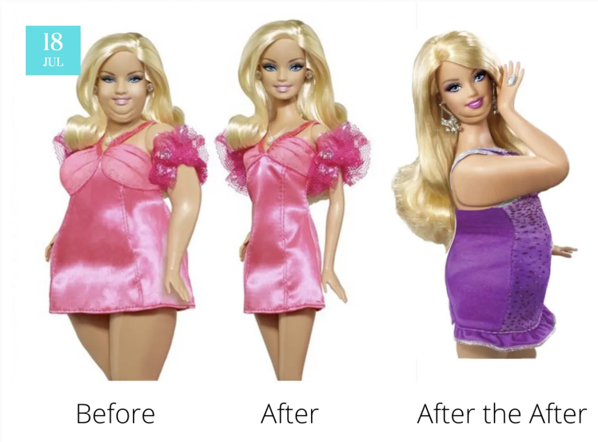 regain after weight loss surgery
