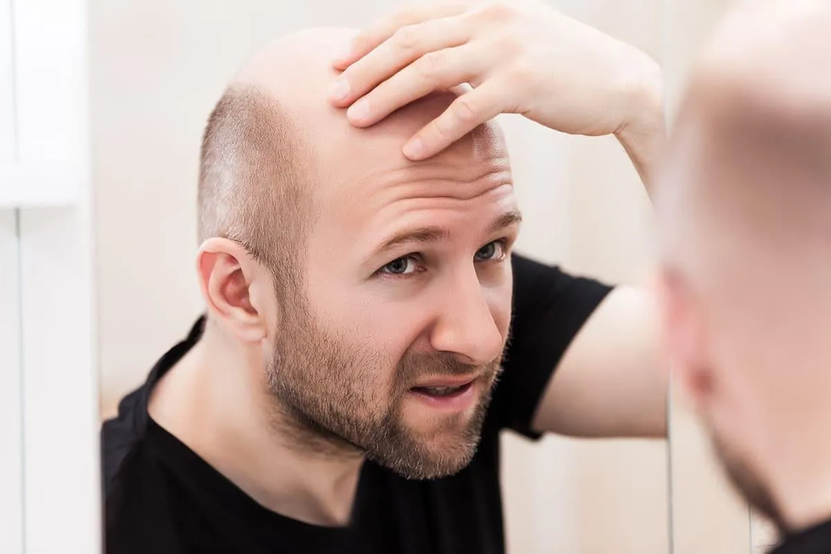 The Secret Dangers of Pharmaceuticals for Hair Loss Prevention