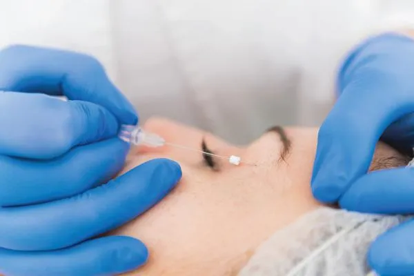 Facial Threads