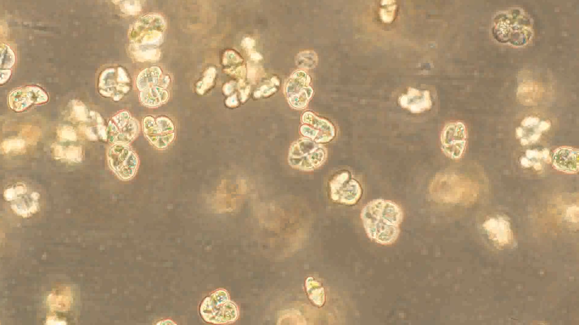 Microscopic image of algae blooms