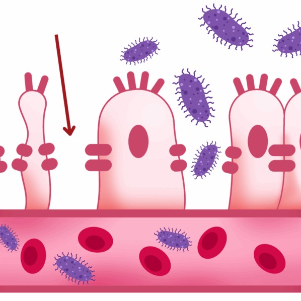 Leaky Gut 101: How It’s Wreaking Havoc on Your Health And How to Fix It