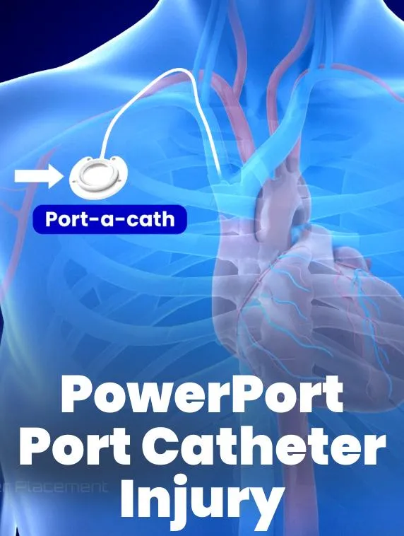 Close-up of a Bard PowerPort medical device and a concerned patient in a hospital bed, representing injuries and complications from PowerPort malfunctions.