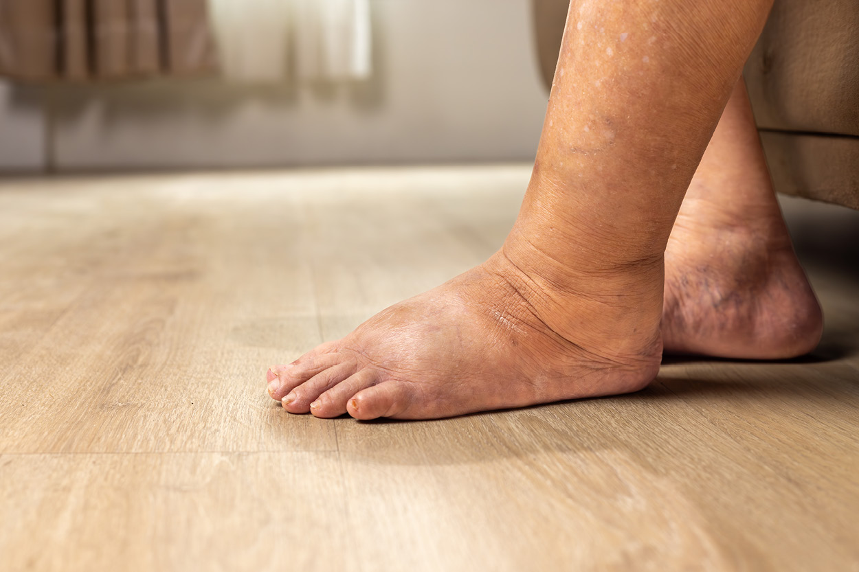 Fascia og lymfesystemets sammenheng