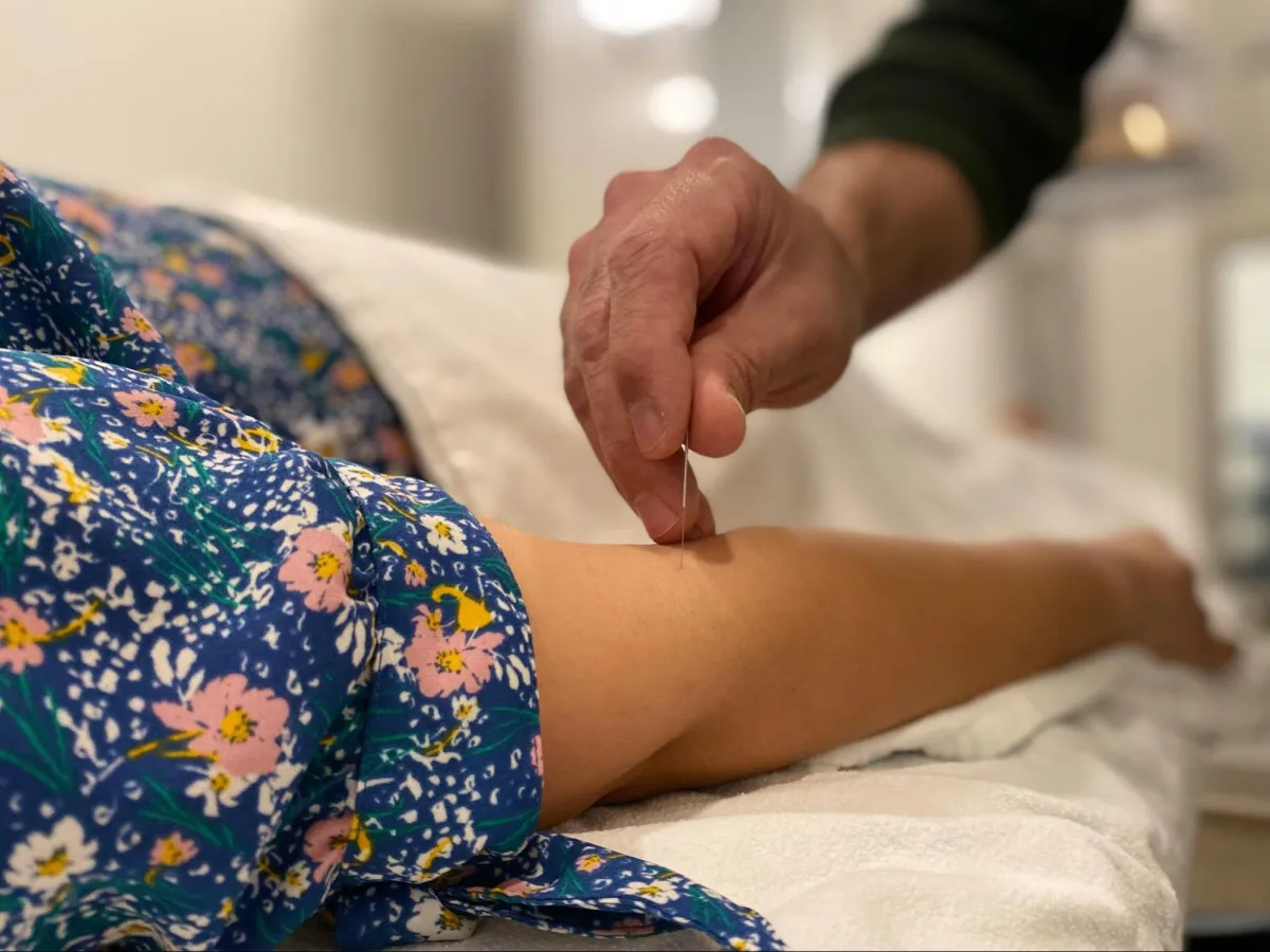 Can Acupuncture Cause Blood Clots?