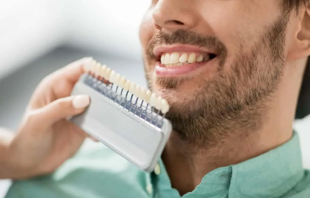 Should You Choose Porcelain Crowns or Veneers For Your Smile Makeover?