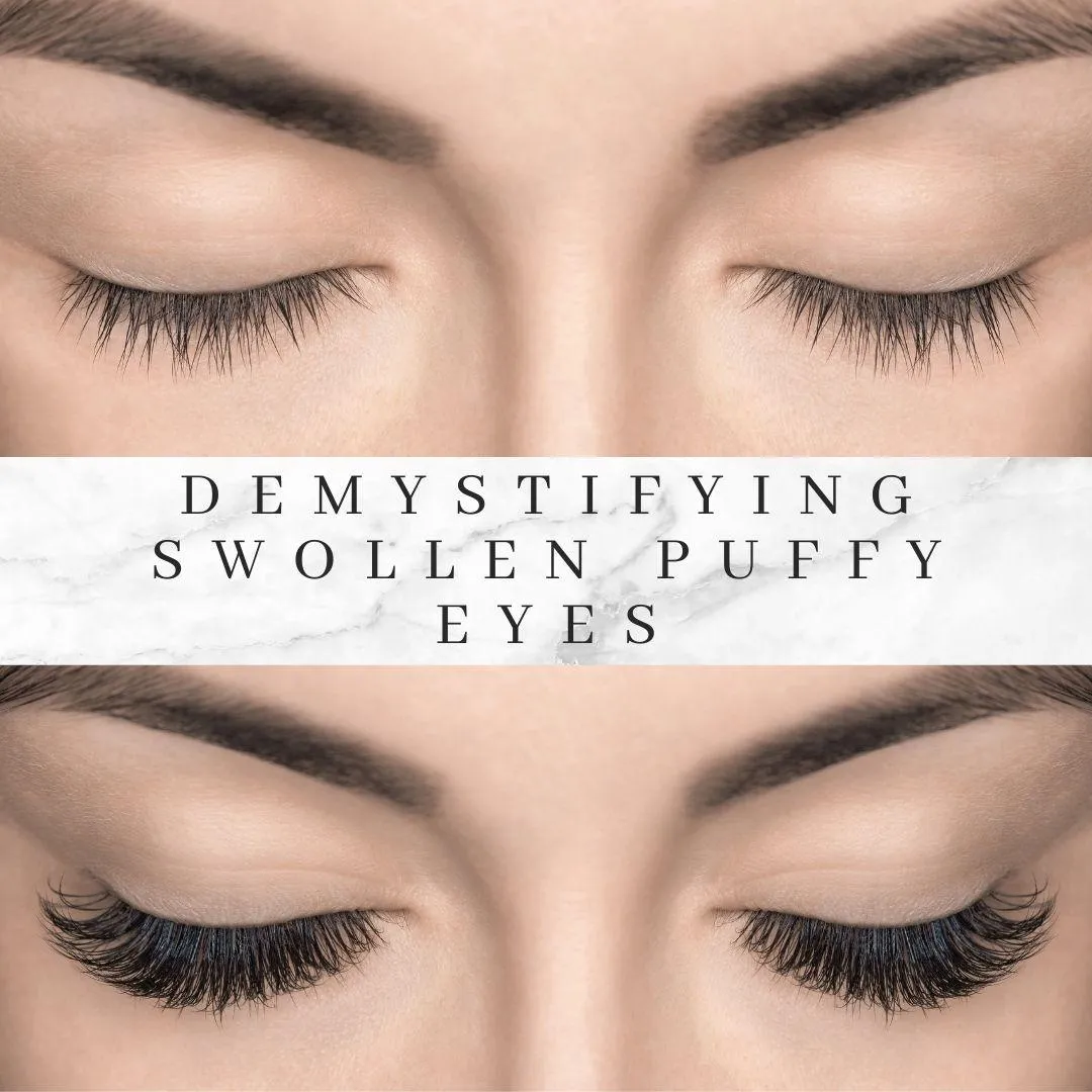 Demystifying Swollen Puffy Eyes: Insights from Mr Ghabra
