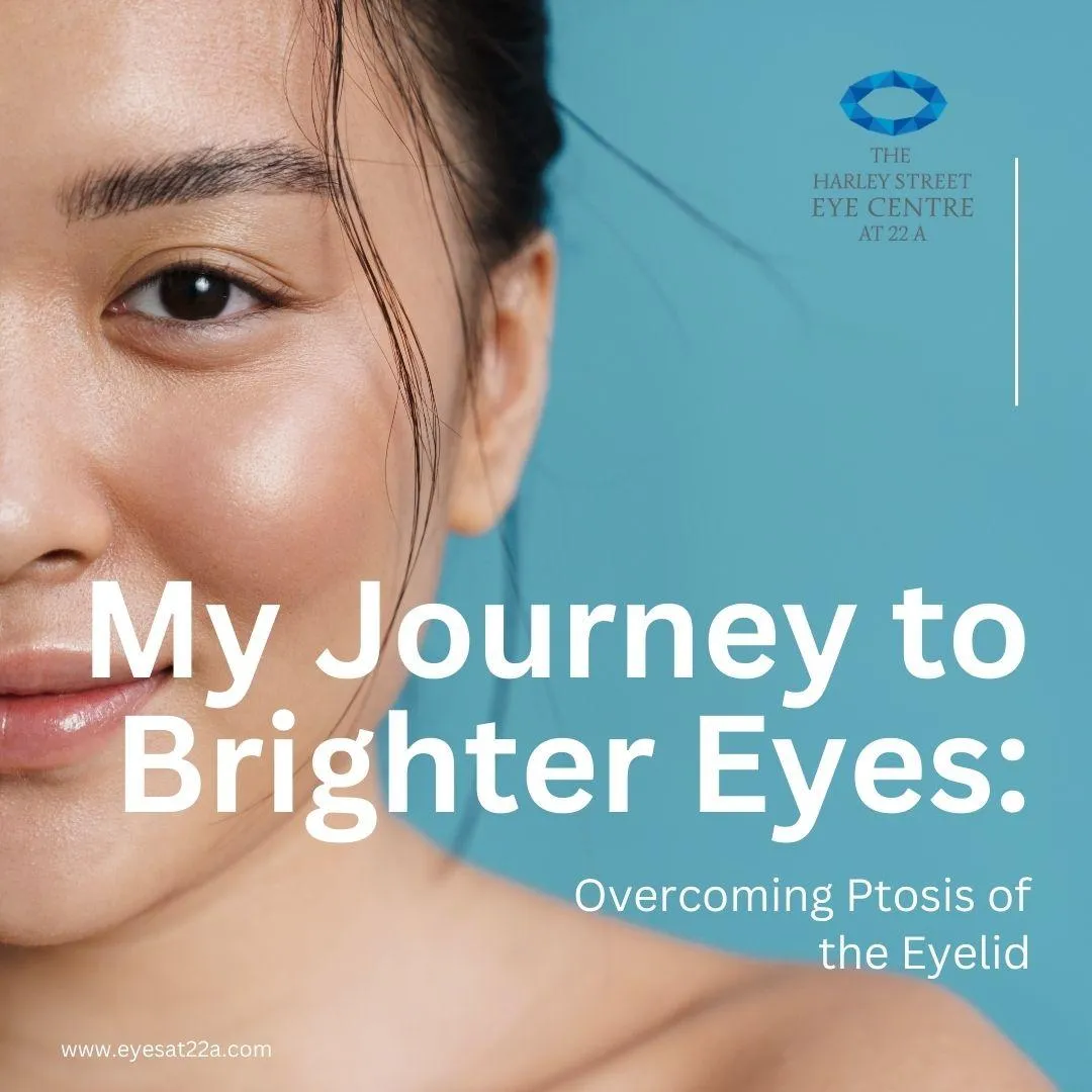 My Journey to Brighter Eyes: Overcoming Ptosis of the Eyelid