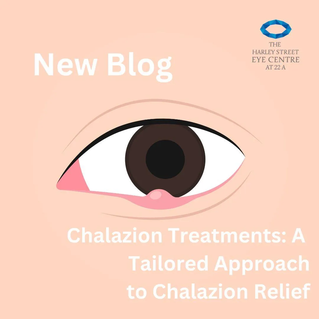 Chalazion Treatments: A Tailored Approach to Chalazion Relief