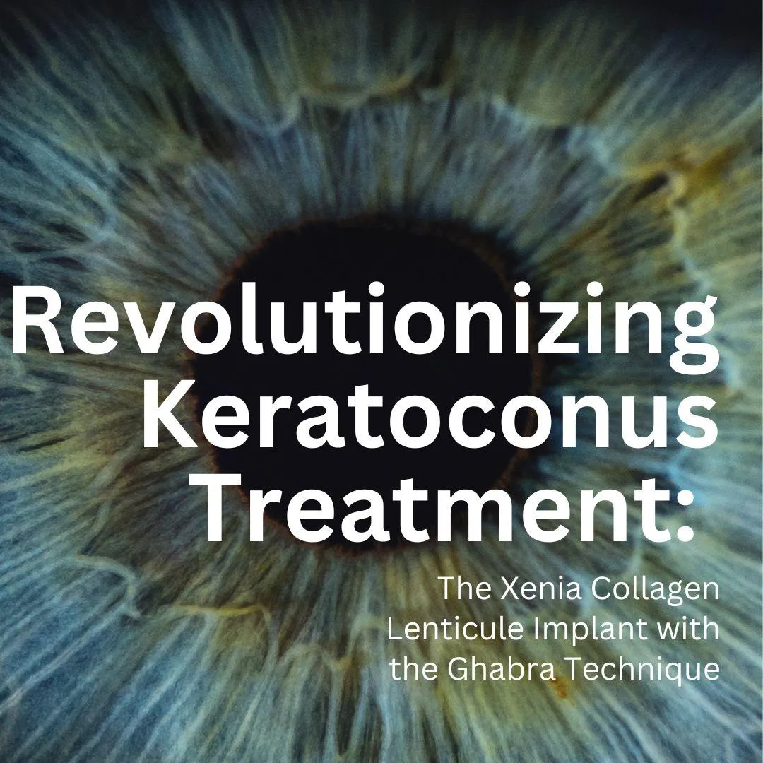 Revolutionizing Keratoconus Treatment: The Xenia Collagen Lenticule Implant with the Ghabra Technique