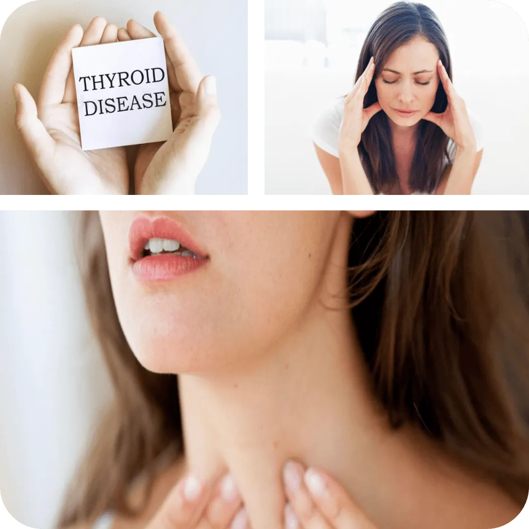 Thyroid Issues: 10 Common Questions (and What They Could Mean for Adults)