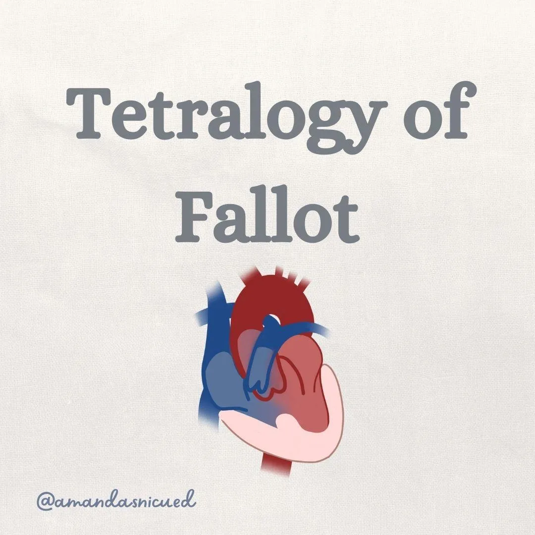 Tetralogy of Fallot Post