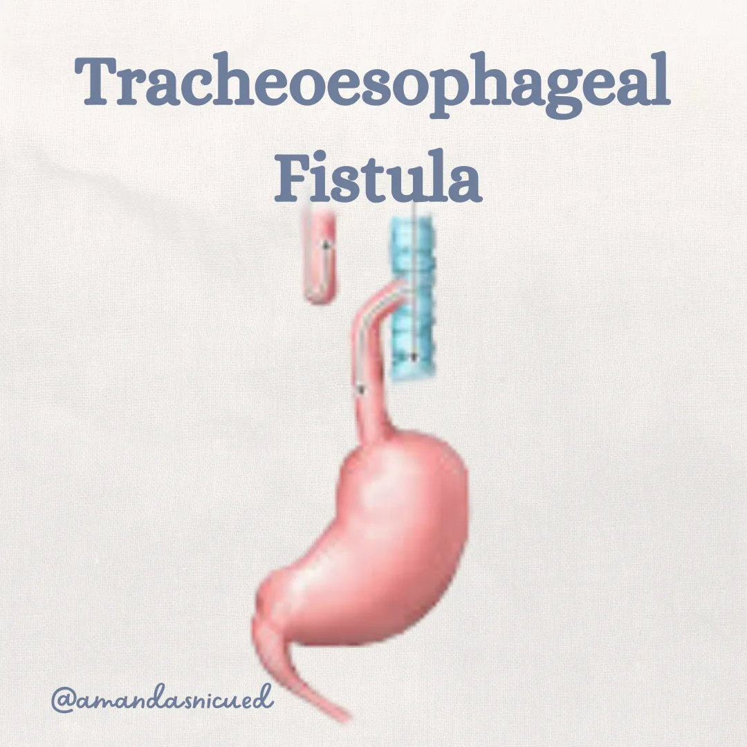 tracheoesophageal fistula