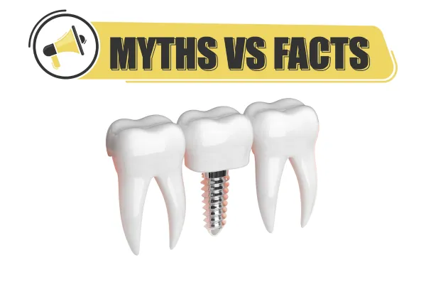 Grand Junction dental implant myths