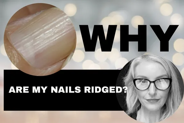 Why Are My Nails Ridged?