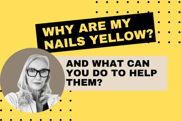 Why Are My Nails Yellow? (And What Can I Do About It?)
