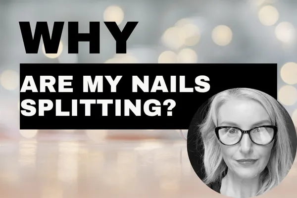 Why Are My Nails Splitting?