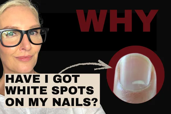 Why Have I Got White Spots on My Nails?