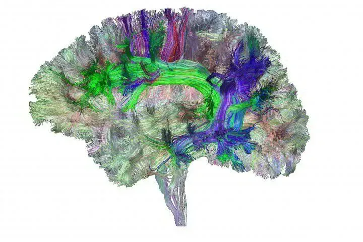 Human Brain 
