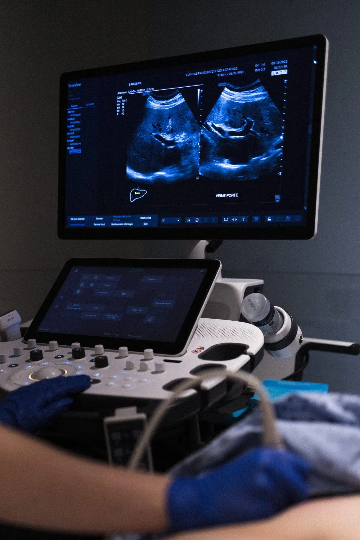 Technicien effectuant une échographie abdominale