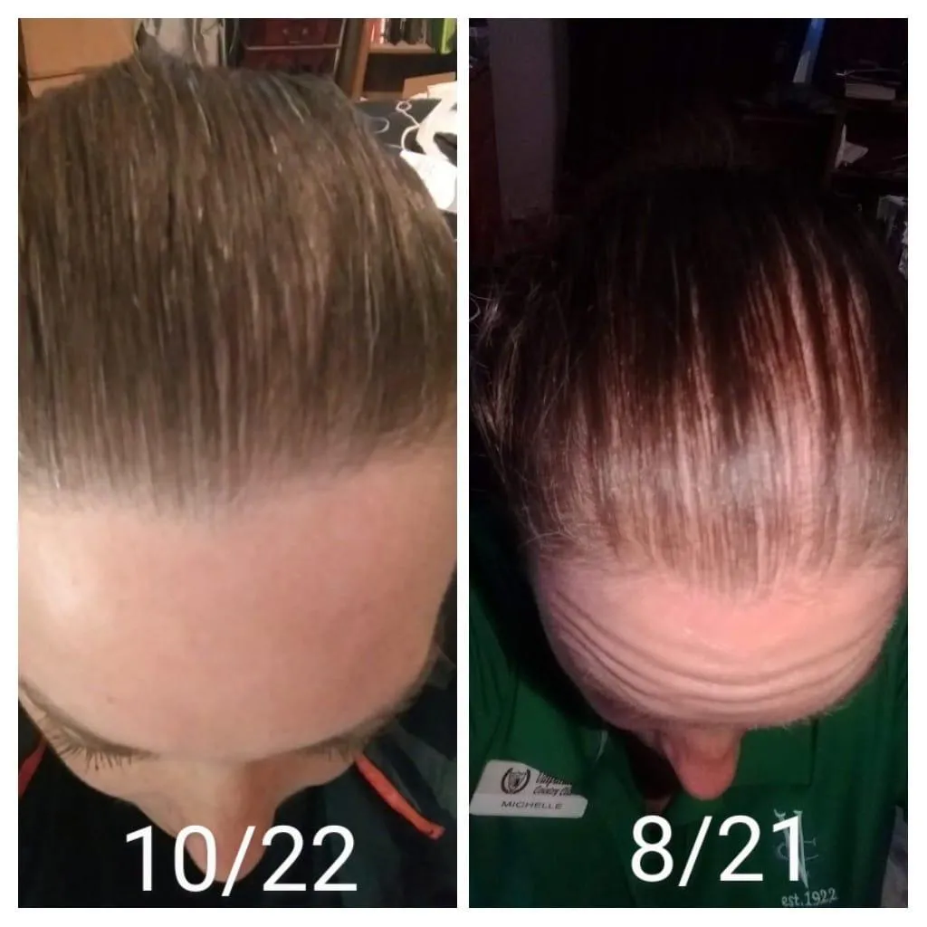 Collagen hair growth 